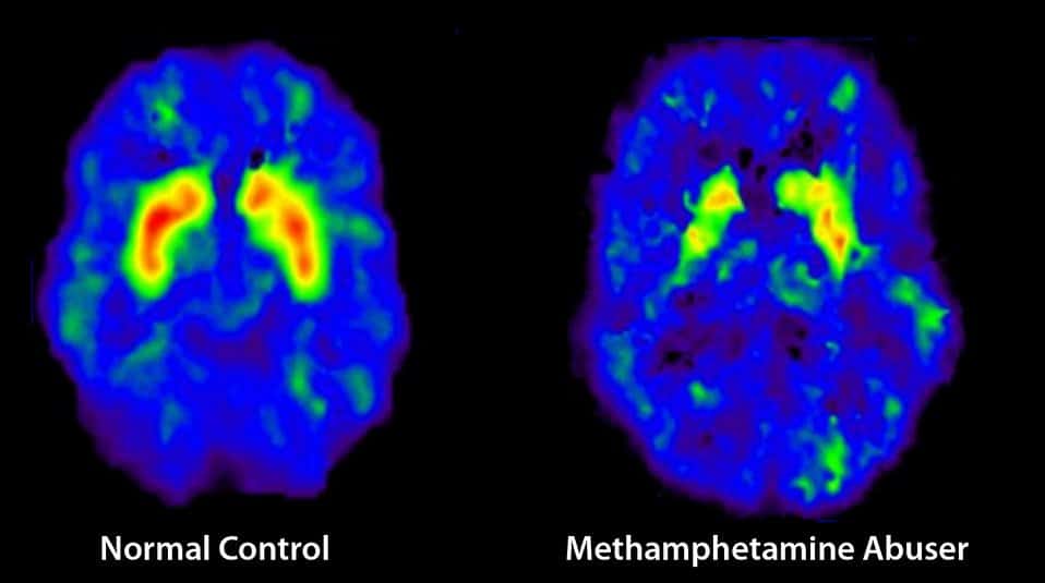 brain impulse control on meth vs normal